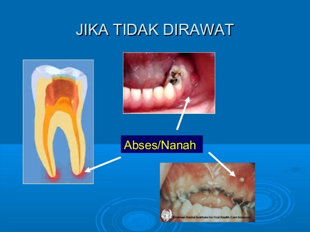 AMALAN KESIHATAN PERGIGIAN