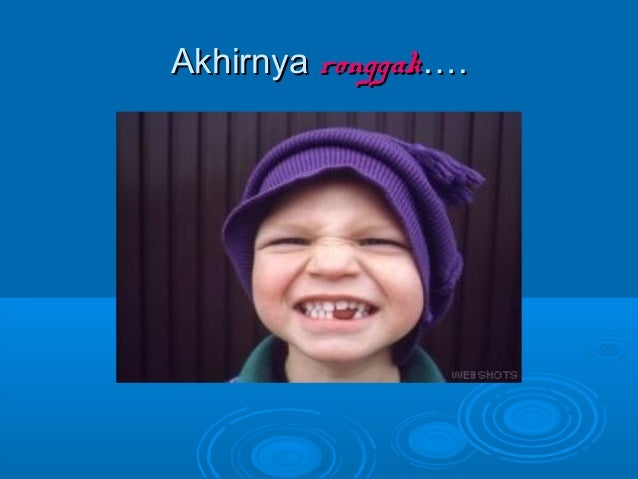 Ubat Gigi Goyang - Flipcard Template