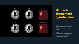 Från
Kräver radiologer och fokuserat,
tidskrävande manuell analys av
bilder.
Till
Segmentering på millisekunder
Resultat i nivå med de bästa
radiologerna i världen
Hitta och
segmentera
hjärntumörer
Flair T1C True tumor
T1 T2 Predicted tumor
 