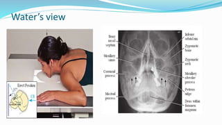 Radiography Anatomy of Skull | PPTX