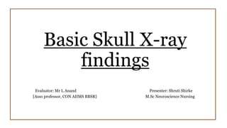 Basic Skull X-ray
findings
Evaluator: Mr L Anand Presenter: Shruti Shirke
[Asso professor, CON AIIMS BBSR] M.Sc Neuroscience Nursing
 