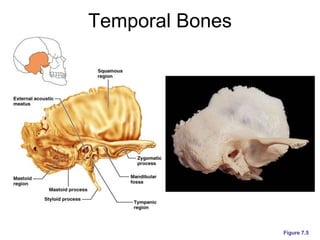 Temporal Bones
Figure 7.5
 