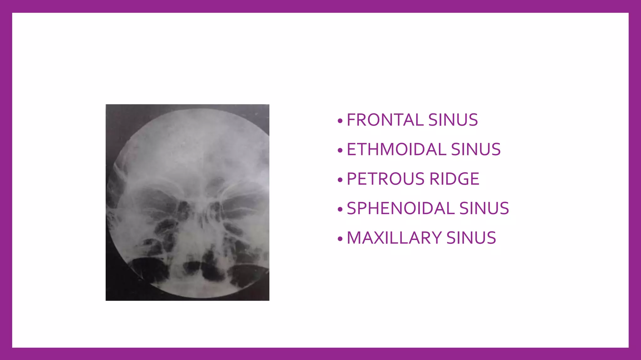 Petrous Ridge Positioning Chart Skull Radiography techniques and reporting | PPTX