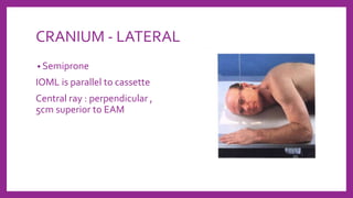 CRANIUM - LATERAL
• Semiprone
IOML is parallel to cassette
Central ray : perpendicular ,
5cm superior to EAM
 