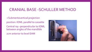 CRANIAL BASE -SCHULLER METHOD
• Submentovertical projection
position: IOML parallel to cassette
Central ray -perpendicular to IOML
between angles of the mandible
2cm anterior to level EAM
 