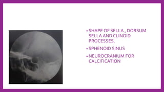 • SHAPE OF SELLA , DORSUM
SELLA AND CLINOID
PROCESSES.
• SPHENOID SINUS
• NEUROCRANIUM FOR
CALCIFICATION
 