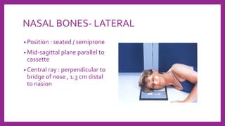 NASAL BONES- LATERAL
• Position : seated / semiprone
• Mid-sagittal plane parallel to
cassette
• Central ray : perpendicular to
bridge of nose , 1.3 cm distal
to nasion
 