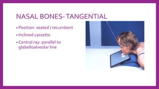 NASAL BONES-TANGENTIAL
• Position: seated / recumbent
• Inclined cassette
• Central ray: parallel to
glabelloalveolar line
 