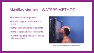 Maxillay sinuses –WATERS METHOD
• Parietocanthal projection
• Position:hyperextend patient’s
neck
• OML forms 37 degree to cassette
• MML is perpendicular to cassette
• Central ray: perpendicular- exit at
the acanthion
 