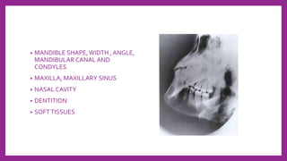 • MANDIBLE SHAPE,WIDTH , ANGLE,
MANDIBULAR CANAL AND
CONDYLES
• MAXILLA, MAXILLARY SINUS
• NASAL CAVITY
• DENTITION
• SOFTTISSUES
 