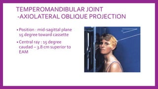 TEMPEROMANDIBULAR JOINT
-AXIOLATERAL OBLIQUE PROJECTION
• Position : mid-sagittal plane
15 degree toward cassette
• Central ray : 15 degree
caudad – 3.8 cm superior to
EAM
 