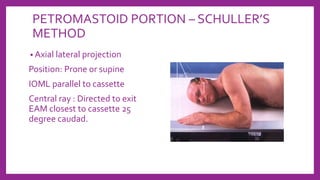 PETROMASTOID PORTION – SCHULLER’S
METHOD
• Axial lateral projection
Position: Prone or supine
IOML parallel to cassette
Central ray : Directed to exit
EAM closest to cassette 25
degree caudad.
 