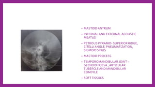 • MASTOIDANTRUM
• INTERNALAND EXTERNALACOUSTIC
MEATUS
• PETROUS PYRAMID- SUPERIOR RIDGE,
CITELLIANGLE, PNEUMATIZATION,
SIGMOID SINUS
• MASTOID PROCESS
• TEMPOROMANDIBULAR JOINT –
GLENOID FOSSA , ARTICULAR
TUBERCLEAND MANDIBULAR
CONDYLE
• SOFTTISSUES
 