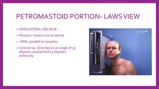 PETROMASTOID PORTION- LAWSVIEW
• AXIOLATERAL OBLIQUE
• Position- head in a true lateral.
• IOML parallel to cassette.
• Central ray -Directed at an angle of 15
degrees caudad and 15 degrees
anteriorly
 