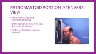 PETROMASTOID PORTION -STENVERS
VIEW
• AXIOLATERAL OBLIQUE-
POSTERIOR PROFILE
• prone position, or seated . Head 45
degrees to the cassette
• Central ray-Directed 12 degrees
cephalad.
 