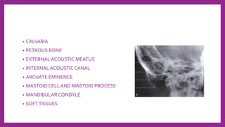 • CALVARIA
• PETROUS BONE
• EXTERNAL ACOUSTIC MEATUS
• INTERNAL ACOUSTIC CANAL
• ARCUATE EMINENCE
• MASTOID CELL AND MASTOID PROCESS
• MANDIBULAR CONDYLE
• SOFTTISSUES
 