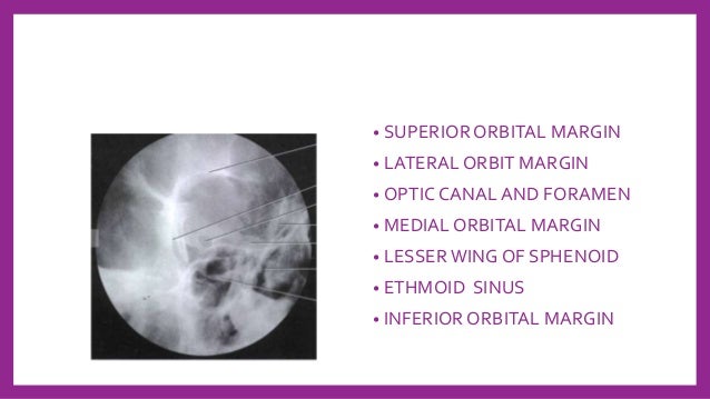 Skull Radiography Techniques And Reporting Skull Radiography Techniques And Reporting