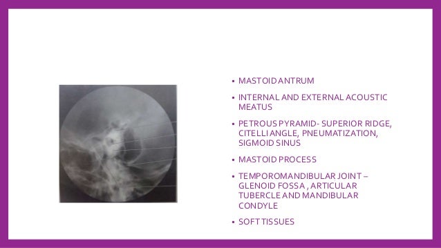 Skull Radiography Techniques And Reporting