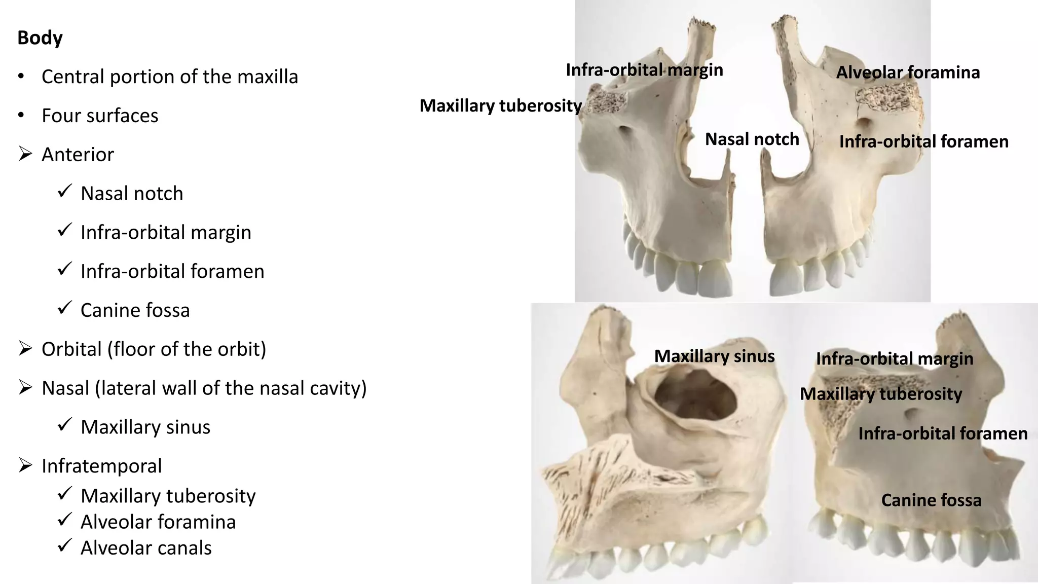 Body
• Central portion of the maxilla
• Four surfaces
 Anterior
 Nasal notch
 Infra-orbital margin
 Infra-orbital foramen
 Canine fossa
 Orbital (floor of the orbit)
 Nasal (lateral wall of the nasal cavity)
 Maxillary sinus
 Infratemporal
 Maxillary tuberosity
 Alveolar foramina
 Alveolar canals
Nasal notch
Infra-orbital margin
Infra-orbital margin
Infra-orbital foramen
Infra-orbital foramen
Canine fossa
Maxillary tuberosity
Maxillary tuberosity
Alveolar foramina
Maxillary sinus
 