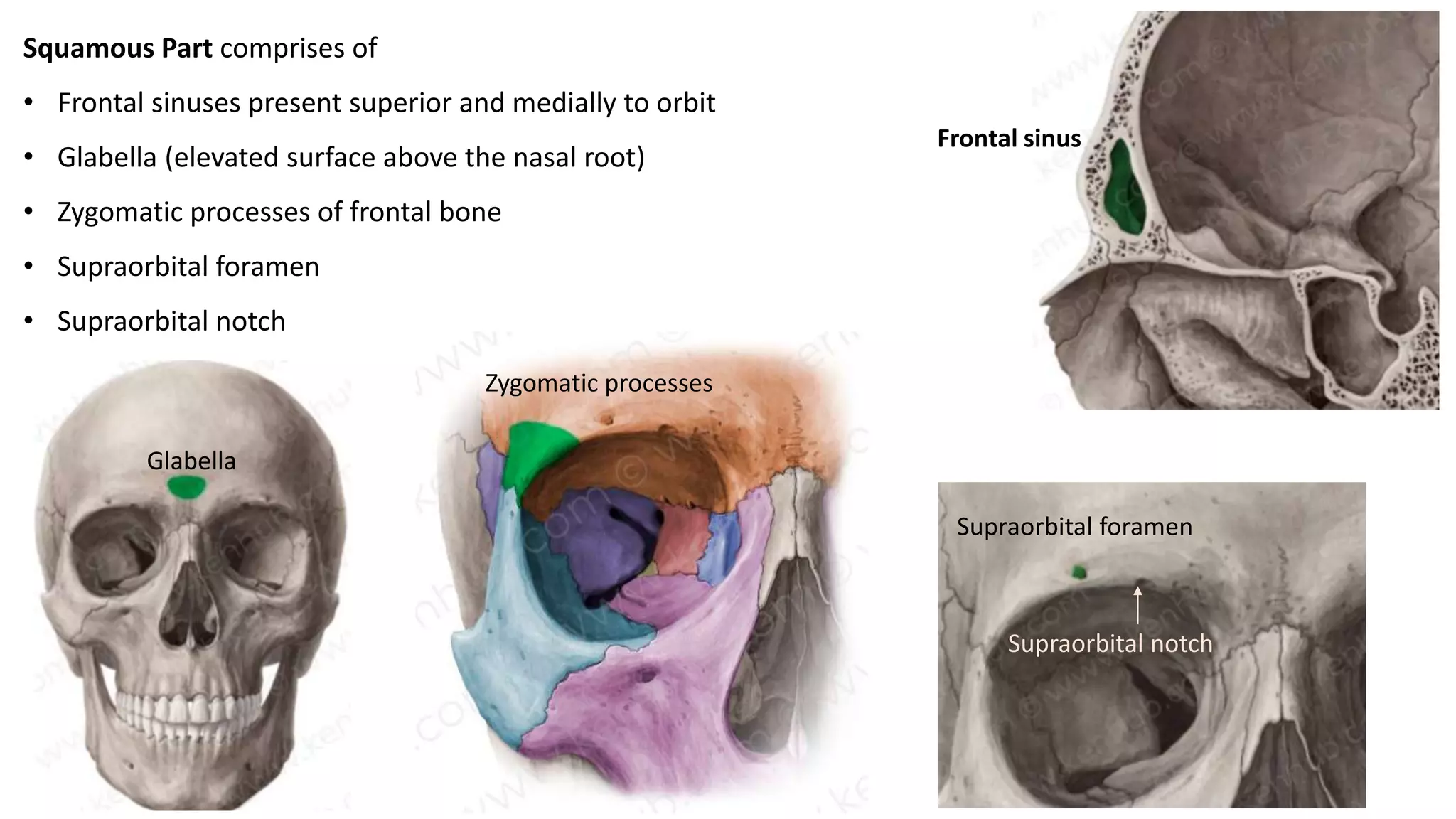 Squamous Part comprises of
• Frontal sinuses present superior and medially to orbit
• Glabella (elevated surface above the nasal root)
• Zygomatic processes of frontal bone
• Supraorbital foramen
• Supraorbital notch
Frontal sinus
Glabella
Zygomatic processes
Supraorbital foramen
Supraorbital notch
 