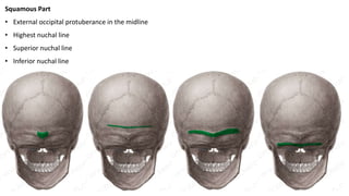 Squamous Part
• External occipital protuberance in the midline
• Highest nuchal line
• Superior nuchal line
• Inferior nuchal line
 