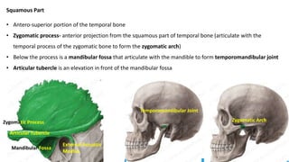 Squamous Part
• Antero-superior portion of the temporal bone
• Zygomatic process- anterior projection from the squamous part of temporal bone (articulate with the
temporal process of the zygomatic bone to form the zygomatic arch)
• Below the process is a mandibular fossa that articulate with the mandible to form temporomandibular joint
• Articular tubercle is an elevation in front of the mandibular fossa
External Acoustic
Meatus
Zygomatic Arch
Zygomatic Process
Mandibular Fossa
Temporomandibular Joint
Articular Tubercle
 