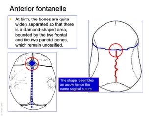 At birth, the bones are quite widely separated so that there is a diamond-shaped area, bounded by the two frontal and the two parietal bones, which remain unossified.  Anterior fontanelle The shape resembles an arrow hence the name sagittal suture 