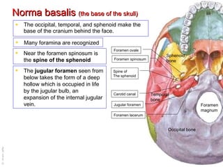 Norma basalis  (the base of the skull) The occipital, temporal, and sphenoid make the base of the cranium behind the face.  Many foramina are recognized  Occipital bone Temporal bone Sphenoid bone Foramen ovale Foramen spinosum Foramen lacerum Carotid canal Jugular foramen Foramen magnum Near the foramen spinosum is the  spine of the sphenoid Spine of The sphenoid The  jugular foramen  seen from below takes the form of a deep hollow which is occupied in life by the jugular bulb, an expansion of the internal jugular vein. 