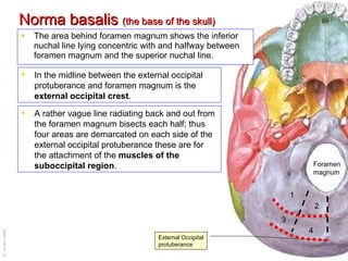 Norma basalis  (the base of the skull) The area behind foramen magnum shows the inferior nuchal line lying concentric with and halfway between foramen magnum and the superior nuchal line.  A rather vague line radiating back and out from the foramen magnum bisects each half; thus four areas are demarcated on each side of the external occipital protuberance these are for the attachment of the  muscles of the suboccipital region . In the midline between the external occipital protuberance and foramen magnum is the  external occipital crest .  Foramen magnum External Occipital protuberance 1 2 3 4 