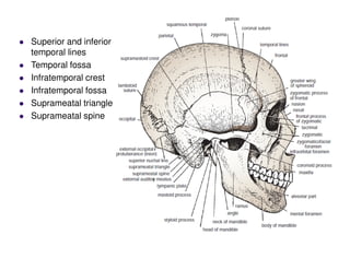 Superior and inferior
temporal lines
Temporal fossa
Infratemporal crest
Infratemporal fossa
Suprameatal triangle
Suprameatal spine
 