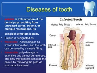 Diseases of tooth
• pulpitis is inflammation of the
dental pulp resulting from
untreated caries, trauma, or
multiple restorations. Its
principal symptom is pain.
• Pulpitis is designated as
• Reversible: Pulpitis begins as
limited inflammation, and the tooth
can be saved by a simple filling.
• Irreversible: pulp damage is
extensive and cannot be reversed.
The only way dentists can stop the
pain is by removing the pulp via
root canal treatment
 