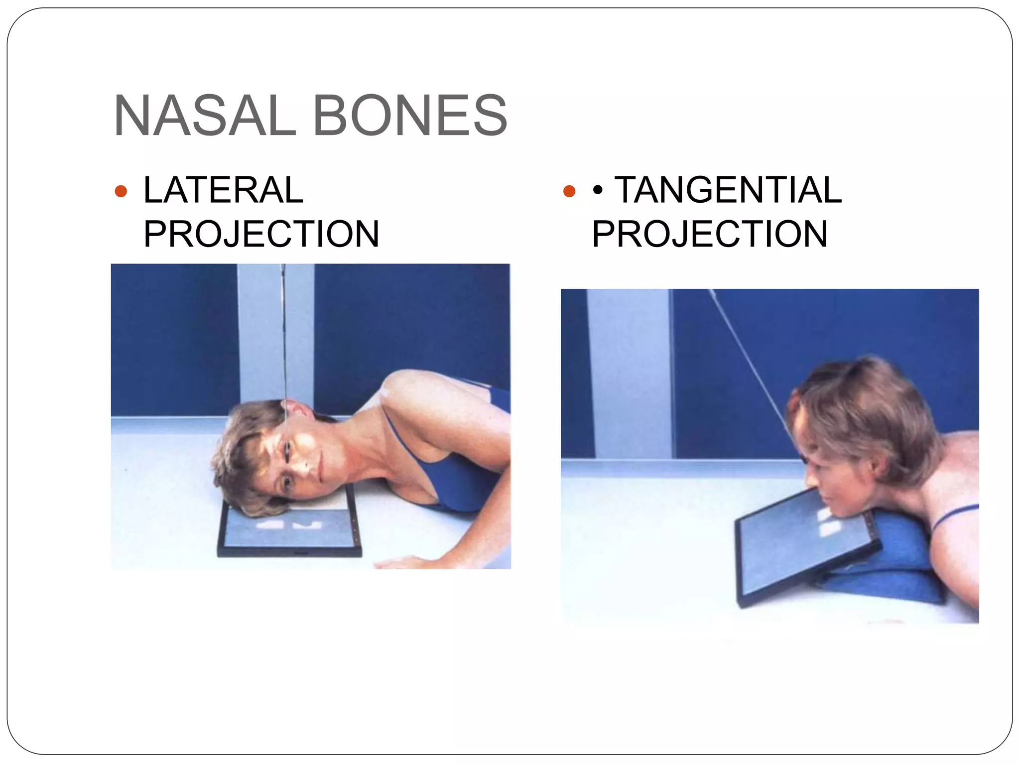 Skull anatomy and positioning | PPTX