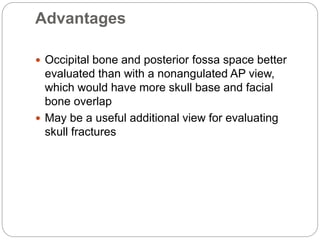 Advantages
 Occipital bone and posterior fossa space better
evaluated than with a nonangulated AP view,
which would have more skull base and facial
bone overlap
 May be a useful additional view for evaluating
skull fractures
 