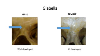 Glabella
MALE FEMALE
Well developed Ill developed
 