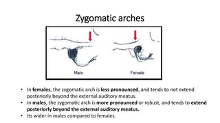 Zygomatic arches
• In females, the zygomatic arch is less pronounced, and tends to not extend
posteriorly beyond the external auditory meatus.
• In males, the zygomatic arch is more pronounced or robust, and tends to extend
posteriorly beyond the external auditory meatus.
• Its wider in males compared to females.
 