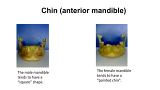 Chin (anterior mandible)
The male mandible
tends to have a
“square” shape.
The female mandible
tends to have a
“pointed chin”.
 