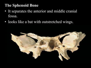 The Sphenoid Bone
• It separates the anterior and middle cranial
fossa.
• looks like a bat with outstretched wings.
 