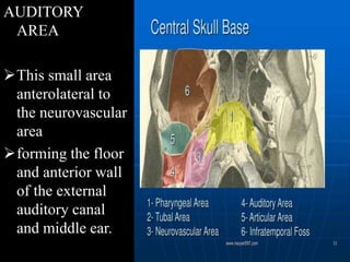 AUDITORY
AREA
This small area
anterolateral to
the neurovascular
area
forming the floor
and anterior wall
of the external
auditory canal
and middle ear.
 