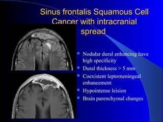 Sinus frontalis Squamous CellSinus frontalis Squamous Cell
Cancer with intracranialCancer with intracranial
spreadspread
 Nodular dural enhancing have
high specificity
 Dural thickness > 5 mm
 Coexistent leptomeningeal
enhancement
 Hypointense leision
 Brain parenchymal changes
 