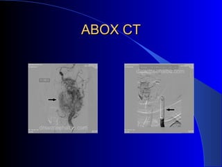 ABOX CTABOX CT
 