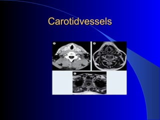 CarotidvesselsCarotidvessels
 
