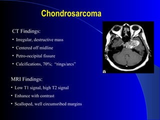 Chondrosarcoma
CT Findings:
• Irregular, destructive mass
• Centered off midline
• Petro-occipital fissure
• Calcifications, 70%; “rings/arcs”
MRI Findings:
• Low T1 signal, high T2 signal
• Enhance with contrast
• Scalloped, well circumsribed margins
 