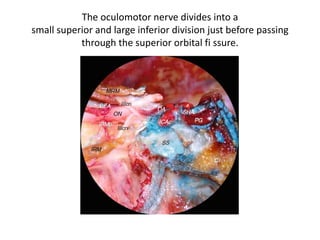 The lower dural ring is given by the COM [ Carotid-oculomotor
membrane ] , that lines the inferior surface of the ACP. It can be visible, through a
transcranial route, only by removing the ACP. The lower dural ring is also called
Perneczky’s ring. Medially the COM blends with the dura that lines the carotid sulcus
(Yasuda et al. 2005 )
Endoscopic supraorbital view with a 30°
down-facing lens -The right portion of the
planum sphenoidale is seen from above.
Right side
 