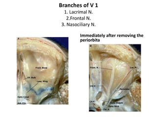 Parts of SOF
1. Lateral part- LFT [ Liver functional tests ] Menumonic – Lacrimal N., Frontal
N.,Trochlear N.
2.Middle part
3. Medial/Inferior part
 