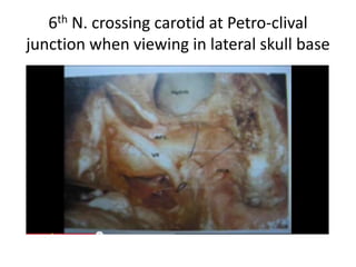 Courtesy Dr. Tomasz Skibinski
 