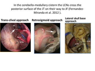 9th nerve – in cadaver
 