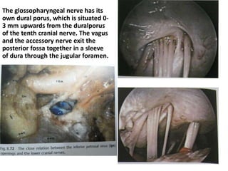Jugular tubercle [ JT ]
AICA antero-inferior cerebellar artery, ASC anterior semicircular canal, BA basilar artery, HC
hypoglossal canal, IAC internal acoustic canal, ICAh horizontal portion of the internal carotid
artery, JT jugular tubercle, LCNs lower cranial nerves, LSC lateral semicircular canal, P pons,
PICA postero-inferior cerebellar artery, PSC posterior semicircular canal, VIcn abducens nerve,
VIIcn facial nerve, white arrow vestibolocochlear nerve
 