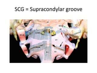 A closer view of the anterior border
of the pontomedullary stem and the
vertebral artery junction and origin
of the basilar artery. Perforating
arteries arise from the vertebral and
basilar arteries.
The endoscope is focusing on the
hypoglossal nerve area. The
posterior inferior cerebellar artery
arises from the vertebral artery in
the background, and runs between
the two bundles of the hypoglossal
nerve.
 