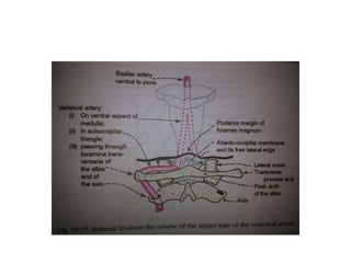 In infrapetrous approach there are chances of injury to 6th nerve [ in dorello’s
canal medial to paraclival carotid ] & 12th nerve
 