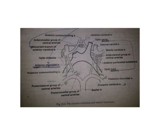 Superior view of the atlas and the axis.
The atlas consists of two thick lateral masses situated
at the anteromedial part of the ring, which are connected
in front by a short anterior arch and posteriorly
by a longer curved posterior arch. 1, anterior arch
of the atlas; 2, superior articular facet is an oval, concave
facet that articulates with the occipital condyle;
3, posterior arch of the atlas; 4, vertebral artery (VA);
5, transverse foramina; 6, transverse process; 7, dens
of the axis.
 